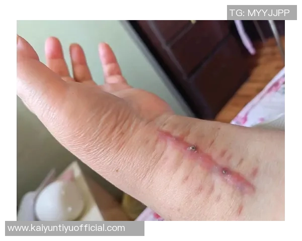 国米官方宣布迪詹纳罗右手腕骨折即将接受手术治疗